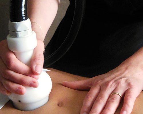 Cryo – Corps Cryo 21 soin Corps