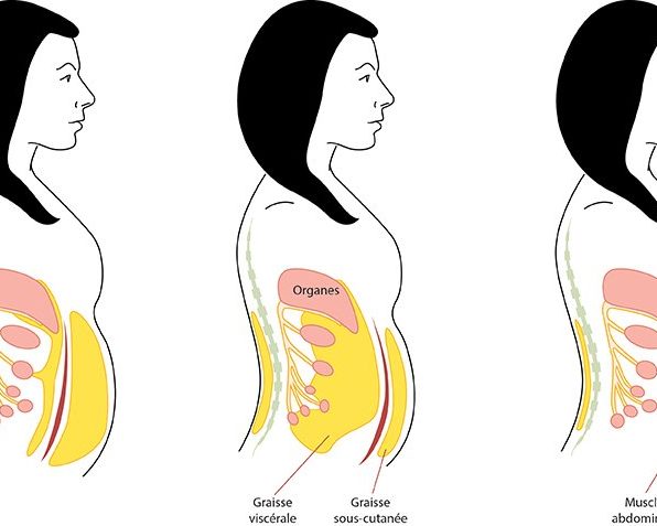 Waves_SchemaGraisse Graisse-viscérale